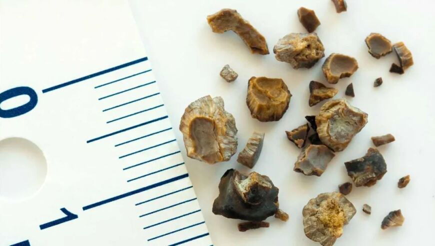 谁给姜妍涂的粉底,今天澳门六彩开奖结果,精准解释落实的人生哲理_手游版V3.13